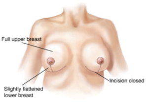   esprit® cosmetic surgeons