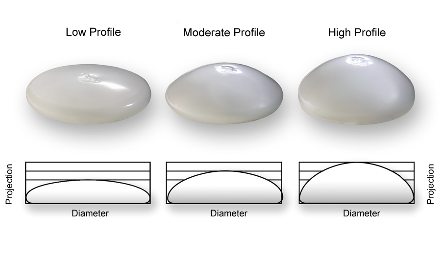Matrix comparison of breast implant profiles esprit® cosmetic surgeons