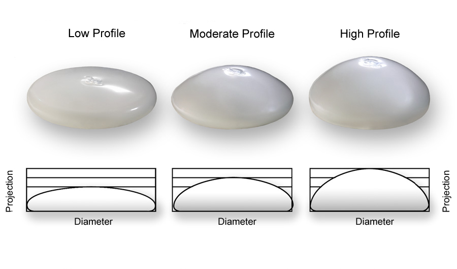 Breast Implant Dimensions Sizes Esprit Cosmetic Surgeons